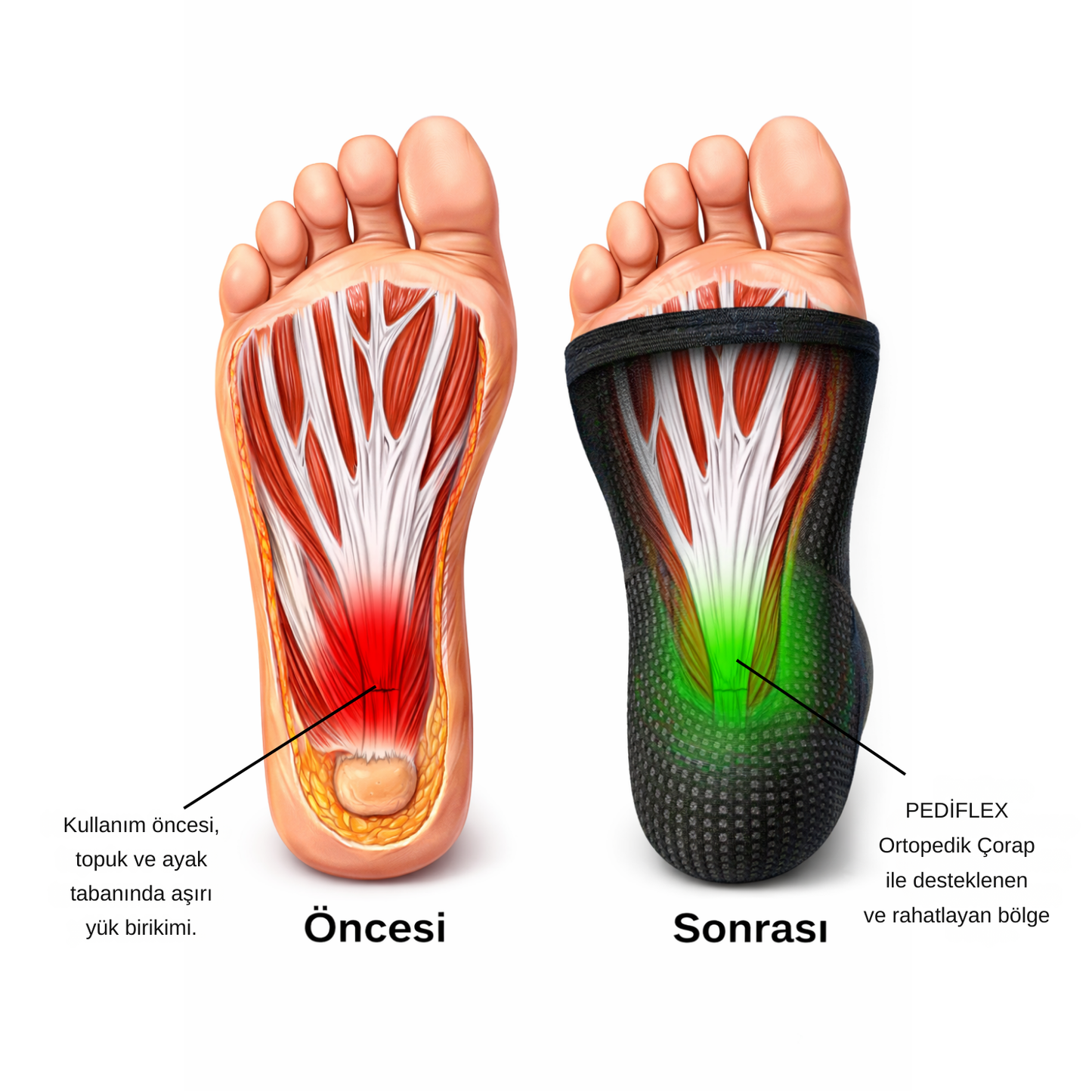 PEDİFLEX Ortopedik Çorap